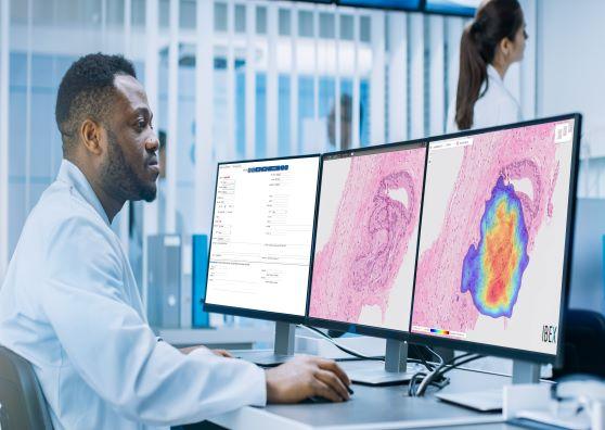 Ibex AI-powered cancer diagnostic solution